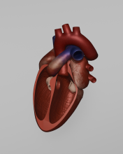 Ventricular Septal Defect Pre-Operation Model